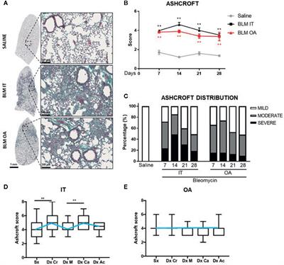 Quantification of Lung Fibrosis in IPF-Like Mouse Model and Pharmacological Response to Treatment by Micro-Computed Tomography